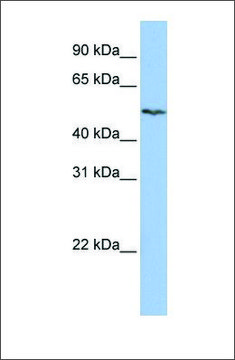 Anti-SLC16A6 antibody produced in rabbit affinity isolated antibody