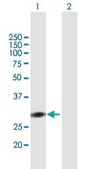 Anti-RAD1 antibody produced in mouse purified immunoglobulin, buffered aqueous solution