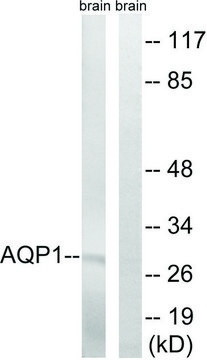 Anti-AQP1 antibody produced in rabbit affinity isolated antibody