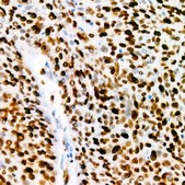 Anti-Ki67 Antibody, clone 5P6N6, Rabbit Monoclonal