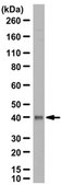 Anti-PSAT1 Antibody from rabbit, purified by affinity chromatography