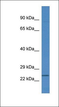 Anti-RNF183 antibody produced in rabbit affinity isolated antibody