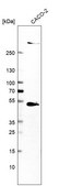Anti-SMYD5 antibody produced in rabbit Prestige Antibodies® Powered by Atlas Antibodies, affinity isolated antibody, buffered aqueous glycerol solution
