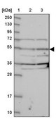 Anti-NARFL antibody produced in rabbit Prestige Antibodies® Powered by Atlas Antibodies, affinity isolated antibody, buffered aqueous glycerol solution