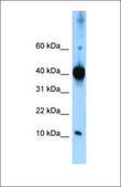 Anti-LSM4 antibody produced in rabbit affinity isolated antibody