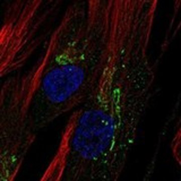 Anti-CHI3L1 antibody produced in rabbit Prestige Antibodies&#174; Powered by Atlas Antibodies, affinity isolated antibody, buffered aqueous glycerol solution