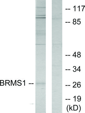 Anti-BRMS1 antibody produced in rabbit affinity isolated antibody