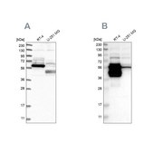 Anti-BAIAP2L1 antibody produced in rabbit Prestige Antibodies® Powered by Atlas Antibodies, affinity isolated antibody, buffered aqueous glycerol solution, Ab3