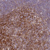 Anti-CR1 antibody produced in rabbit Prestige Antibodies® Powered by Atlas Antibodies, affinity isolated antibody, buffered aqueous glycerol solution