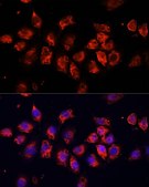 Anti-SMO antibody produced in rabbit