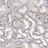 Anti-RBM6 antibody produced in rabbit Prestige Antibodies® Powered by Atlas Antibodies, affinity isolated antibody, buffered aqueous glycerol solution, Ab1