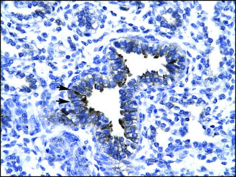 Anti-KIF5A antibody produced in rabbit affinity isolated antibody