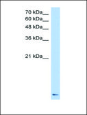 Anti-ZNF706 antibody produced in rabbit affinity isolated antibody