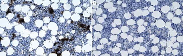 Anti-CD41/ITGA2B Antibody, clone 1F9 ZooMAb&#174; Rabbit Monoclonal recombinant, expressed in HEK 293 cells