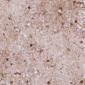 Anti-RARS2 antibody produced in rabbit Prestige Antibodies&#174; Powered by Atlas Antibodies, affinity isolated antibody, buffered aqueous glycerol solution