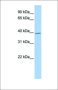 Anti-GNAI1 antibody produced in rabbit affinity isolated antibody