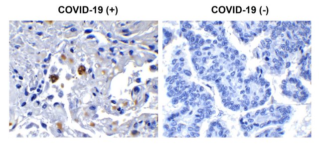 Anti-SARS-CoV-2 (COVID-19) NSP13 (Helicase) antibody produced in rabbit affinity isolated antibody