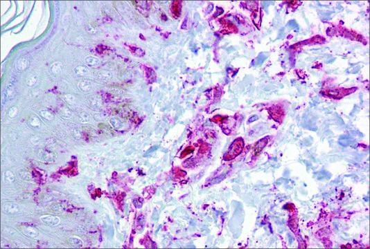 Anti-ZFP36L2 antibody produced in rabbit affinity isolated antibody