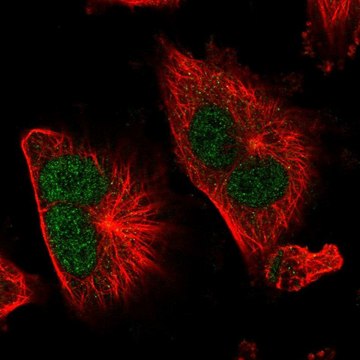 Anti-TSR1 antibody produced in rabbit Prestige Antibodies&#174; Powered by Atlas Antibodies, affinity isolated antibody