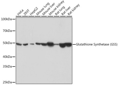 Anti-Glutathione Synthetase (GSS) Antibody, clone 2S9W7, Rabbit Monoclonal