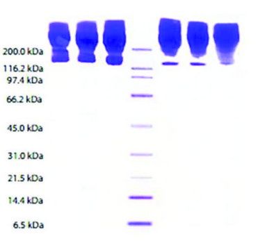 载脂蛋白B 来源于人类血浆 &#8805;95% (SDS-PAGE)