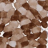 Anti-CYP1B1 antibody produced in rabbit Prestige Antibodies® Powered by Atlas Antibodies, affinity isolated antibody, buffered aqueous glycerol solution