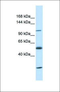 Anti-SLC39A10 antibody produced in rabbit affinity isolated antibody