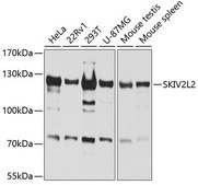 Anti-SKIV2L2 antibody produced in rabbit