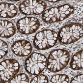 Anti-CCDC51 antibody produced in rabbit Prestige Antibodies® Powered by Atlas Antibodies, affinity isolated antibody, buffered aqueous glycerol solution