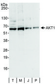 Rabbit anti-AKT1 Antibody, Affinity Purified Powered by Bethyl Laboratories, Inc.