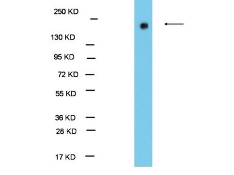 Anti-EHMT1/GLP1 Antibody Upstate&#174;, from rabbit