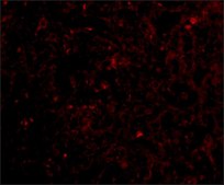 Anti-STEAP1 (ab2) antibody produced in rabbit affinity isolated antibody, buffered aqueous solution