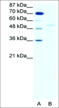 Anti-SMAD5 antibody produced in rabbit affinity isolated antibody