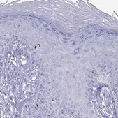 Anti-HLA-DQB2 antibody produced in rabbit Prestige Antibodies® Powered by Atlas Antibodies, affinity isolated antibody, buffered aqueous glycerol solution