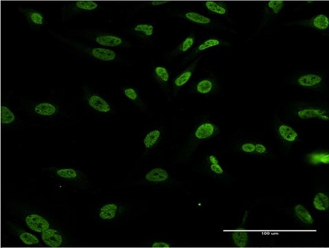 ANTI-DLX1 antibody produced in mouse clone 3F9, purified immunoglobulin, buffered aqueous solution