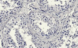 Anti-Ku70/XRCC6 Antibody, clone 1D19-L1 ZooMAb® Rabbit Monoclonal recombinant, expressed in HEK 293 cells