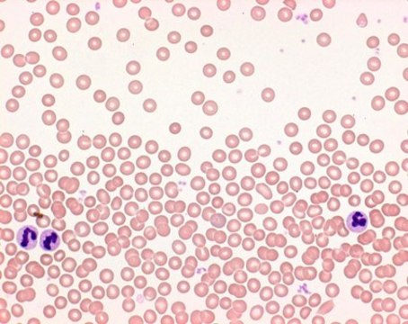 Hemacolor&#174; Rapid staining of blood smear suitable for hematology, staining set for microscopy