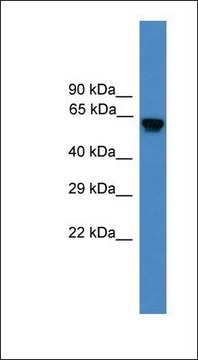 Anti-USP17L2 antibody produced in rabbit affinity isolated antibody