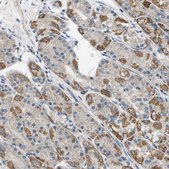 Anti-TAOK3 antibody produced in rabbit Prestige Antibodies® Powered by Atlas Antibodies, affinity isolated antibody, buffered aqueous glycerol solution