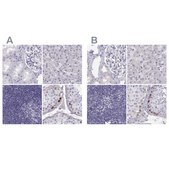 Anti-MAGEB2 Prestige Antibodies&#174; Powered by Atlas Antibodies, affinity isolated antibody