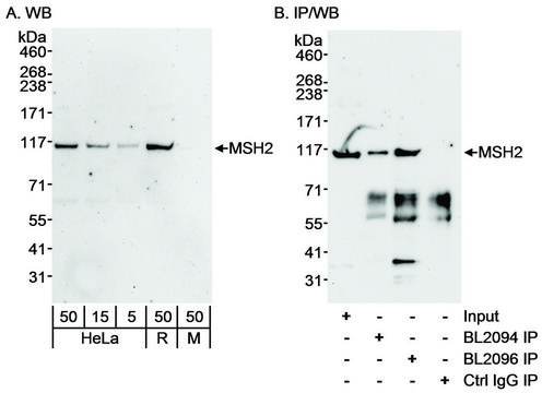 Rabbit anti-MSH2 Antibody, Affinity Purified Powered by Bethyl Laboratories, Inc.