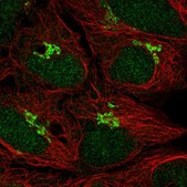 Anti-TP73 antibody produced in rabbit Prestige Antibodies® Powered by Atlas Antibodies, affinity isolated antibody
