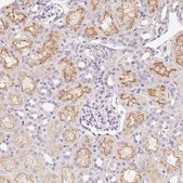 Anti-SLC6A18 antibody produced in rabbit Prestige Antibodies® Powered by Atlas Antibodies, affinity isolated antibody, buffered aqueous glycerol solution