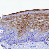 Anti-LOXL1 antibody produced in rabbit Prestige Antibodies® Powered by Atlas Antibodies, affinity isolated antibody, buffered aqueous glycerol solution