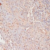 Anti-Phospho-PPP1CA-T320 antibody produced in rabbit