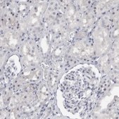 Anti-TNR antibody produced in rabbit Prestige Antibodies® Powered by Atlas Antibodies, affinity isolated antibody, buffered aqueous glycerol solution, Ab2