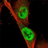 Anti-NOTUM antibody produced in rabbit Prestige Antibodies® Powered by Atlas Antibodies, affinity isolated antibody, buffered aqueous glycerol solution