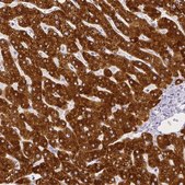 Anti-SLC27A5 antibody produced in rabbit Prestige Antibodies® Powered by Atlas Antibodies, affinity isolated antibody, buffered aqueous glycerol solution