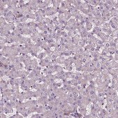 Anti-ATG16L1 antibody produced in rabbit Prestige Antibodies® Powered by Atlas Antibodies, affinity isolated antibody, buffered aqueous glycerol solution