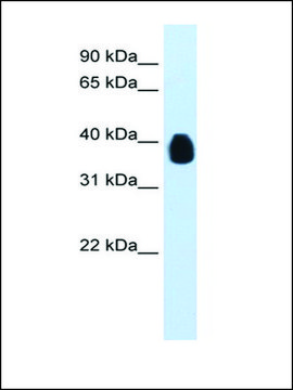 Anti-ETV7 antibody produced in rabbit affinity isolated antibody